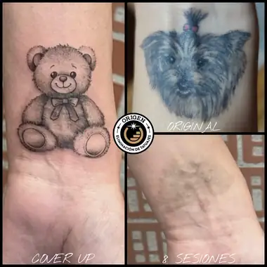 Un perro en la muñeca, aclarado con 8 sesiones y tapado después con un osito de peluche.