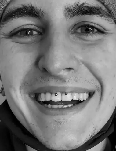 Smiley: una bolita que asoma sobre los dientes de arriba al sonreír, en blanco y negro.