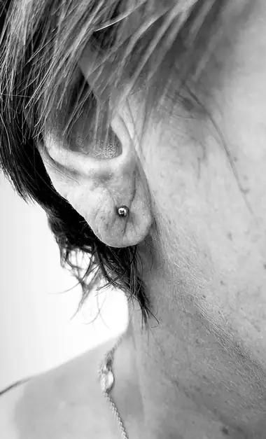 Una bolita en el lóbulo, de perfil, en blanco y negro.